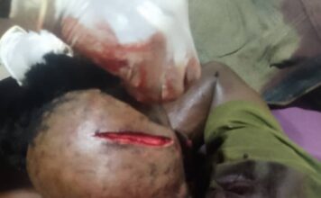 Côte d’Ivoire /Ouragahio : Un jeune homme de plus de 20 ans agressé à coups de machette dans le domicile du chef de village de Bodocipa.