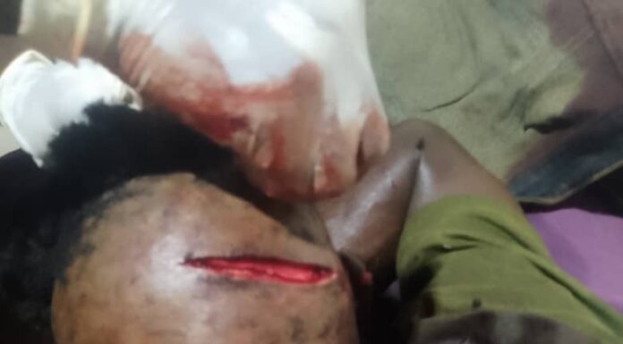 Côte d’Ivoire /Ouragahio : Un jeune homme de plus de 20 ans agressé à coups de machette dans le domicile du chef de village de Bodocipa.